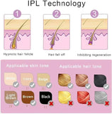 IPL Laser Hair Removal Device - Painless and Safe for All Skin Types, Perfect for Home Use