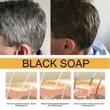 Black hair soap-Experience Nature’s Cleansing Power with Soap Bar