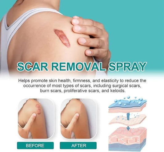 Medical Scar Removal Spray